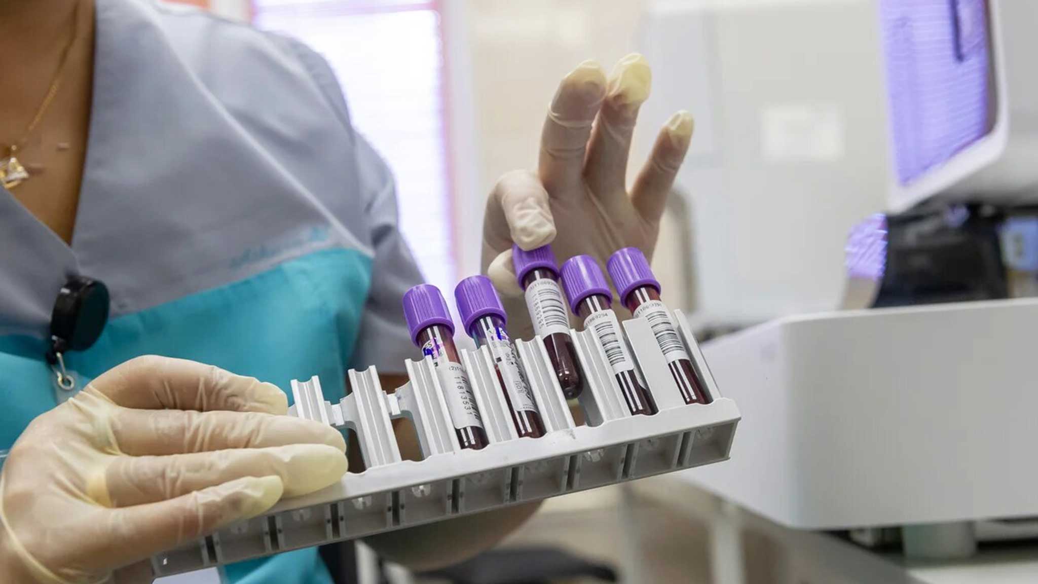 Калькулятор доставки анализов в поликлинику Сыктывкар